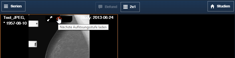 Auflösungsstufe nachladen